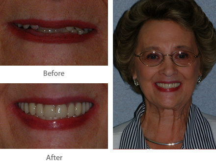 Before and After Dental Treatment Case