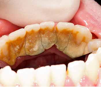 dentist describes effective gum disease treatment options
