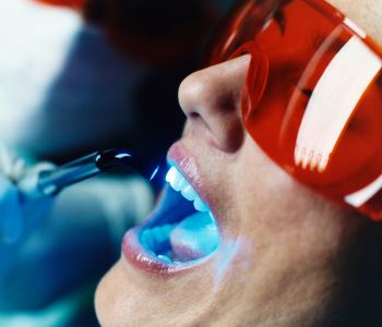 Laser procedures from expert dentist in Lakewood