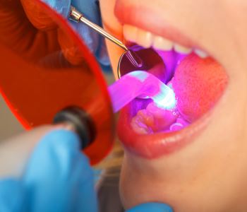 Laser dentistry procedures from expert dentist in Lakewood