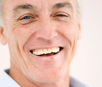 Full cosmetic dentures are available at South Lakewood Dental